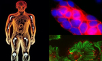 Biomarker